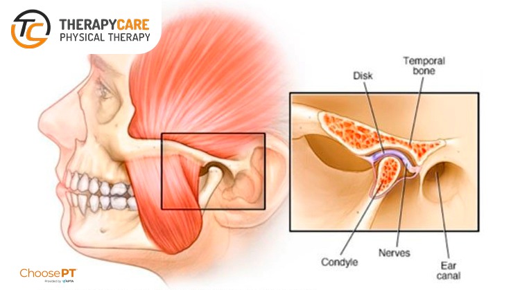 Therapycare Jaw Fracture Blog Image