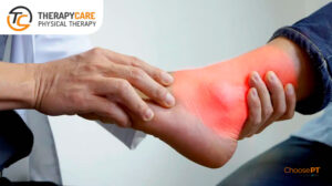 Therapycare Medial Collateral Ligament Injury blog image